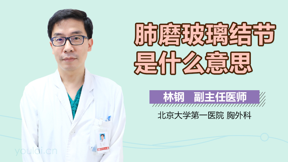 肺磨玻璃结节是什么意思