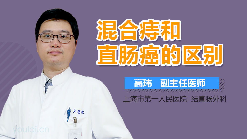 混合痔和直肠癌的区别