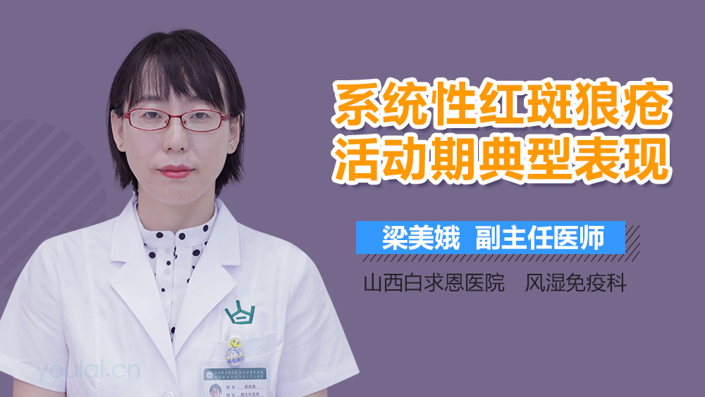 系统性红斑狼疮活动期典型表现