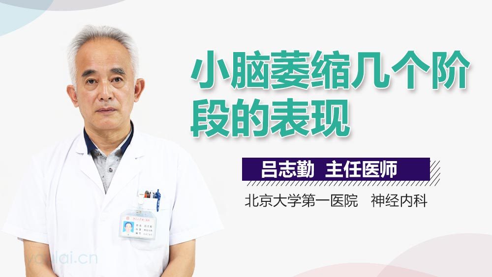 小脑萎缩几个阶段的表现