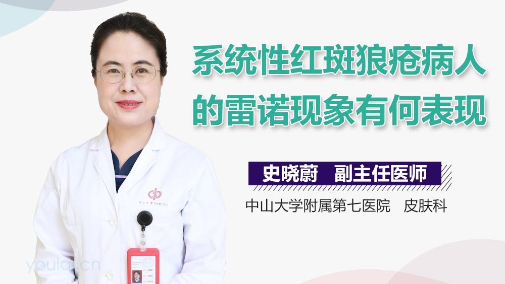 系统性红斑狼疮病人的雷诺现象有何表现