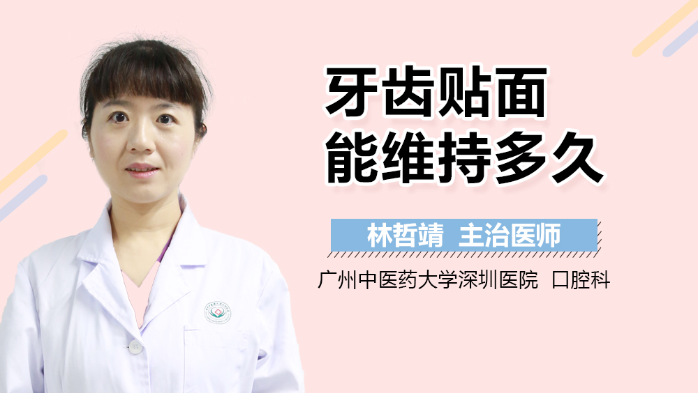 牙齿贴面能维持多久