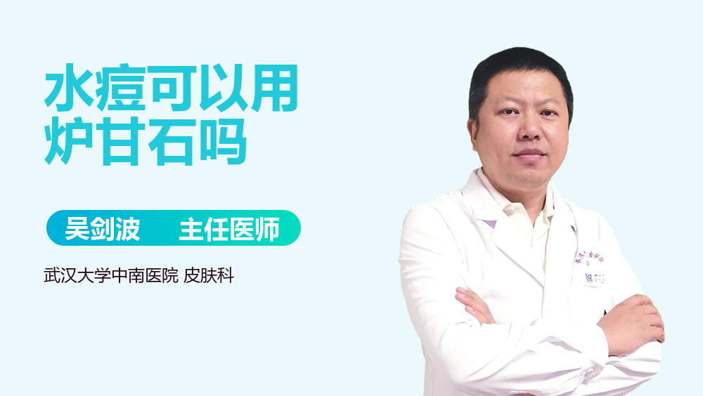 水痘可以用炉甘石吗