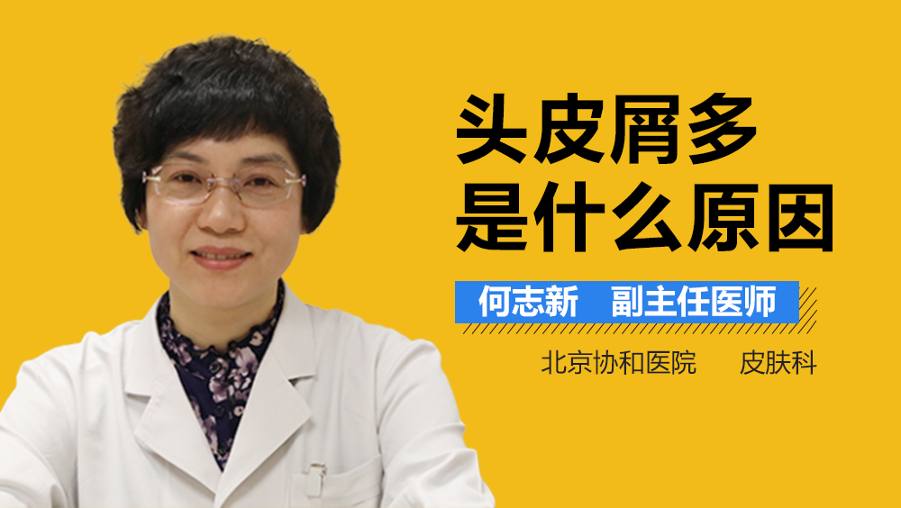 头皮屑多是什么原因