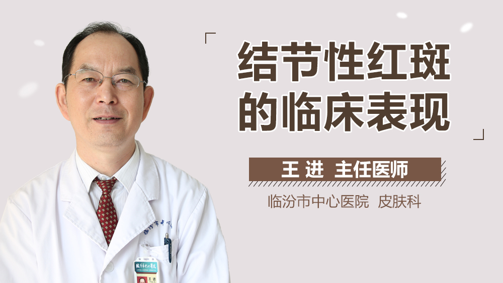 结节性红斑的临床表现
