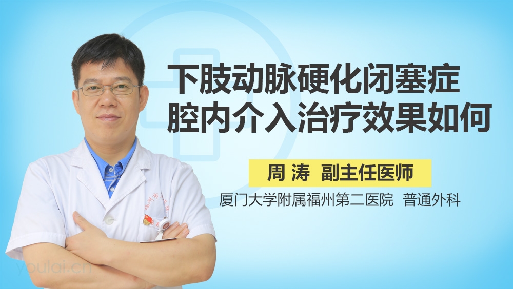下肢动脉硬化闭塞症腔内介入治疗效果如何