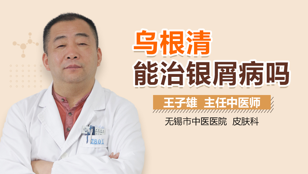 乌根清能治银屑病吗
