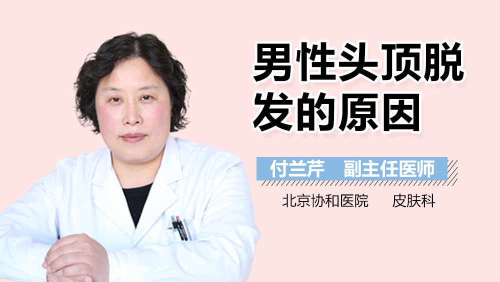 男性头顶脱发的原因