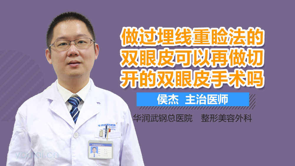 做过埋线重睑法的双眼皮可以再做切开的双眼皮手术吗