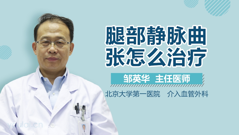 腿部静脉曲张怎么治疗