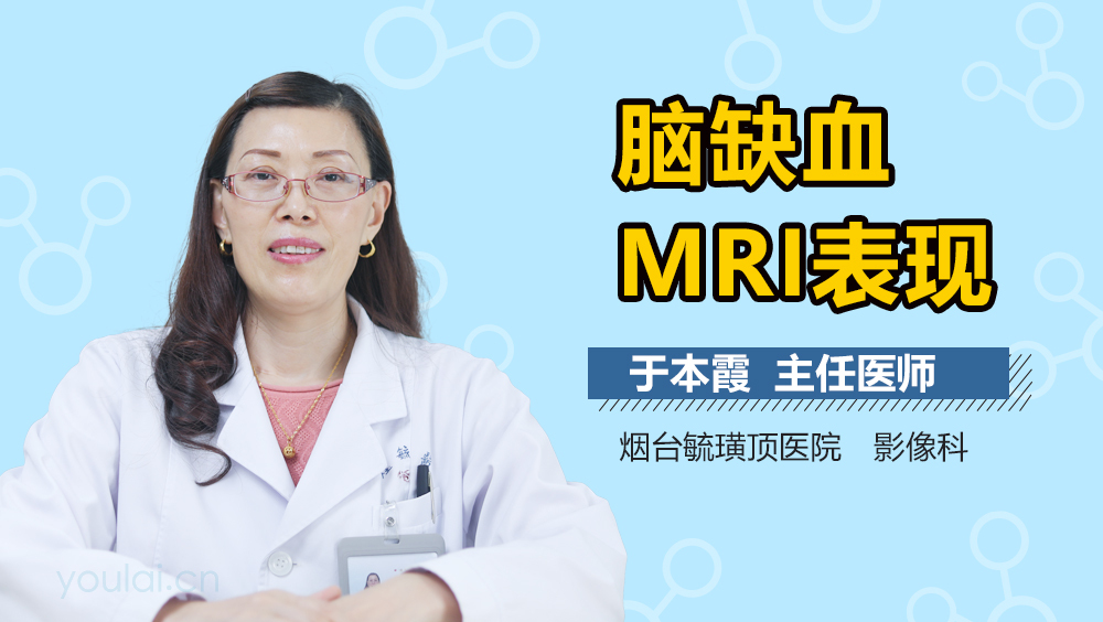 脑缺血MRI表现