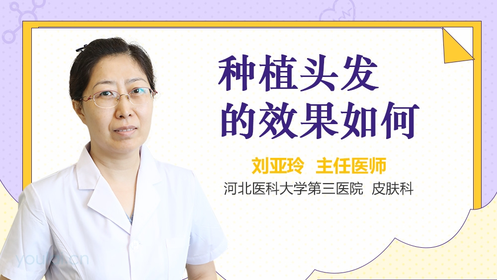 种植头发的效果如何