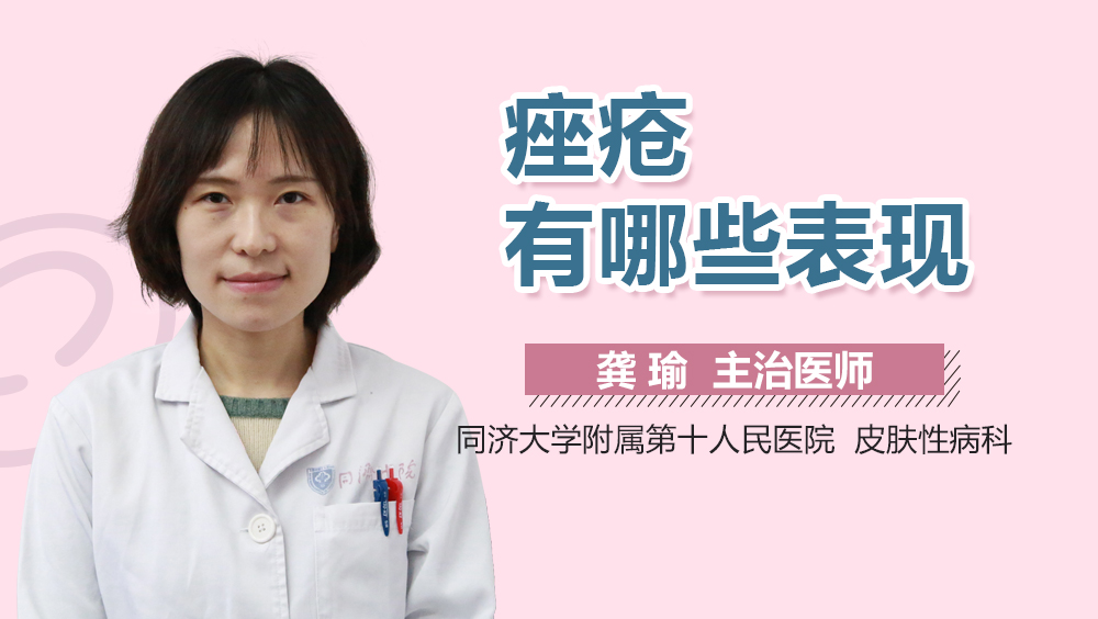 痤疮有哪些表现