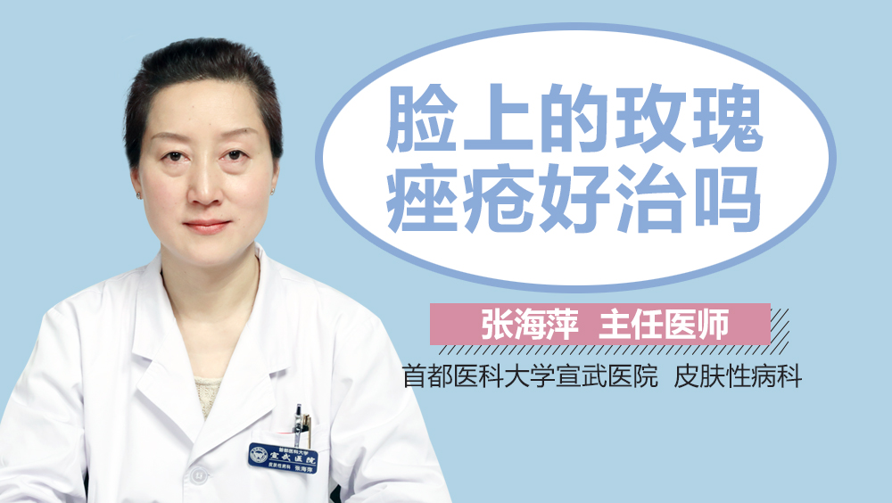脸上的玫瑰痤疮好治吗