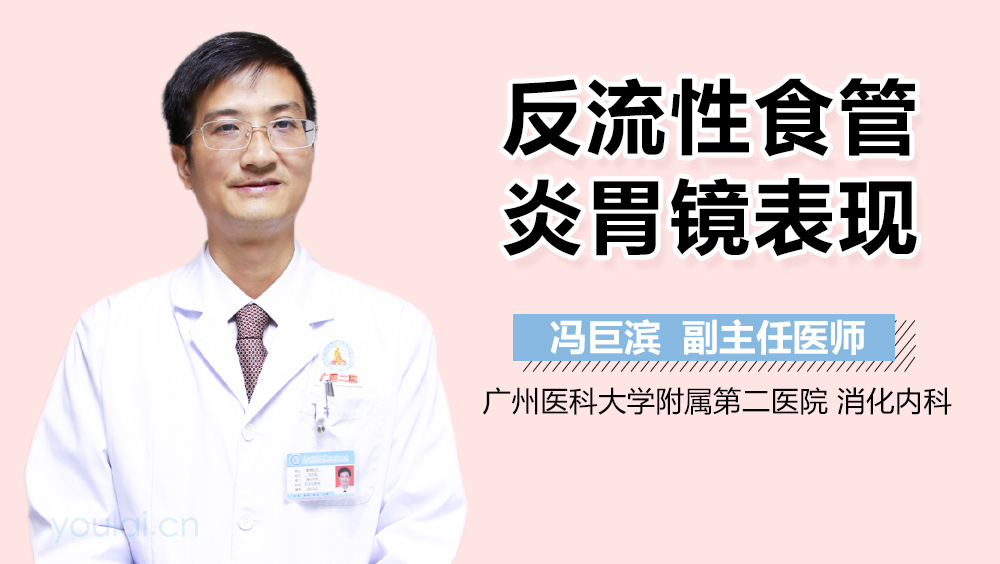 反流性食管炎胃镜表现