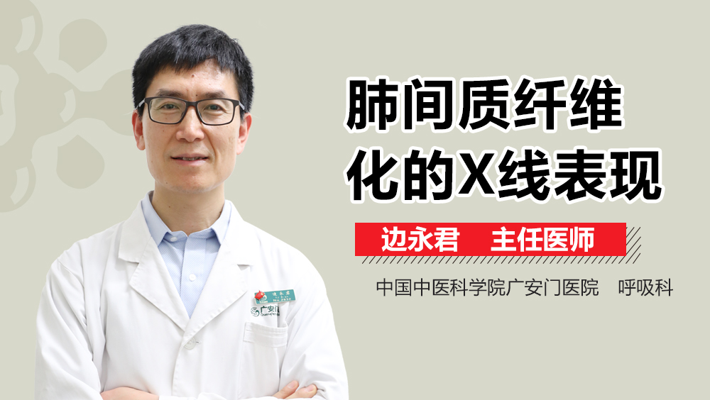 肺间质纤维化的X线表现