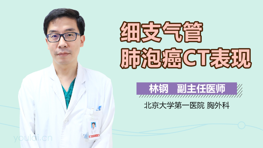 细支气管肺泡癌CT表现