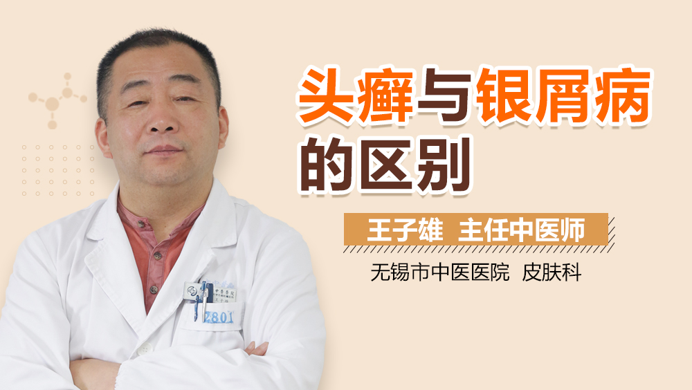 头癣与银屑病的区别
