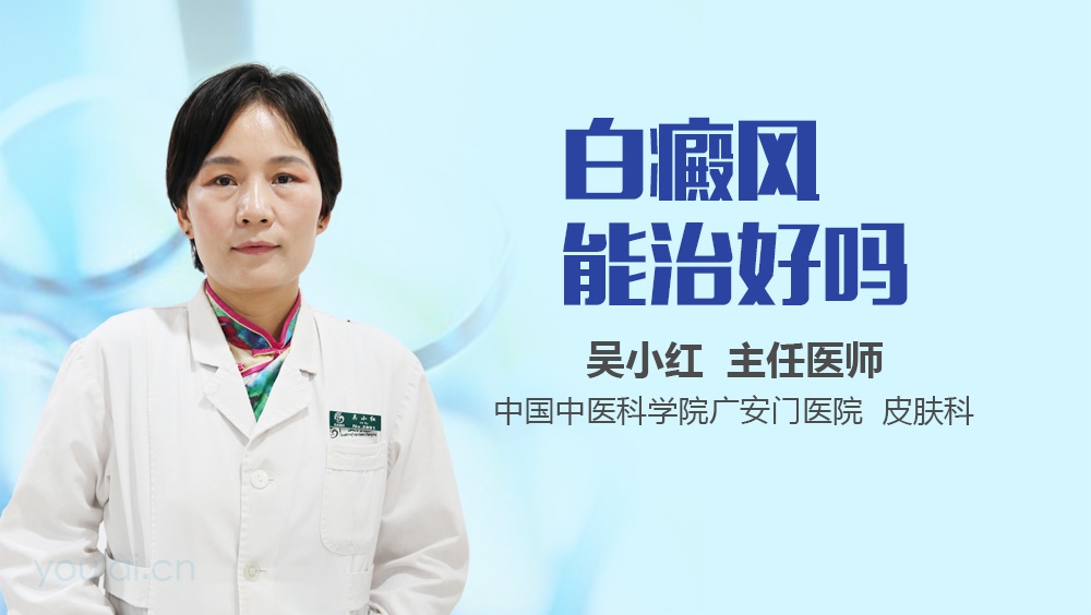 白癜风能治好吗