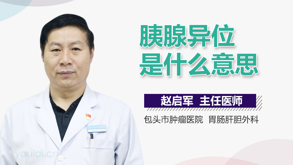 胰腺异位是什么意思