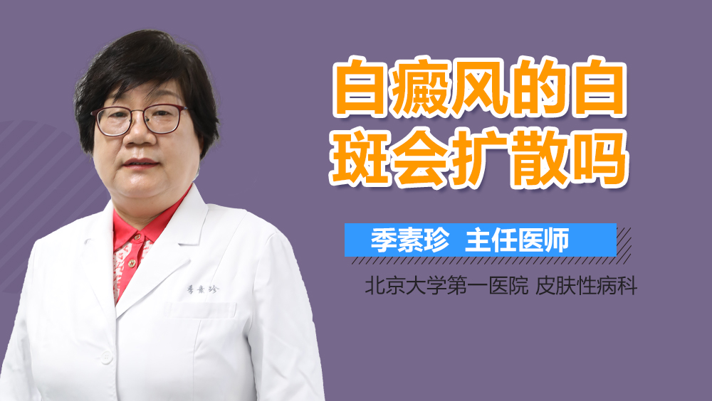 白癜风的白斑会扩散吗