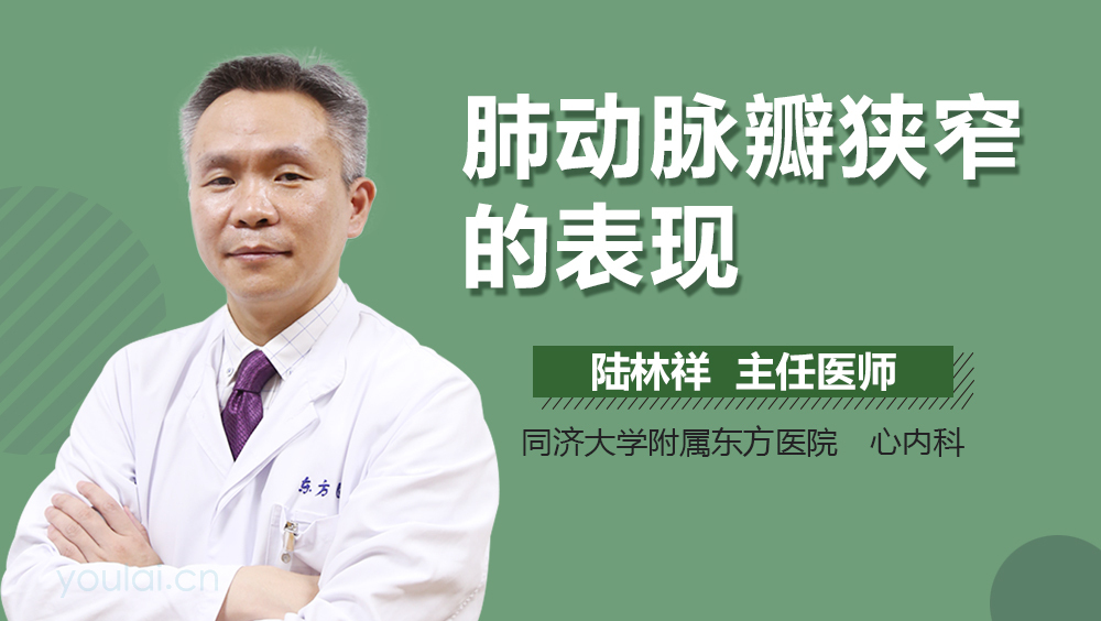 肺动脉瓣狭窄的表现