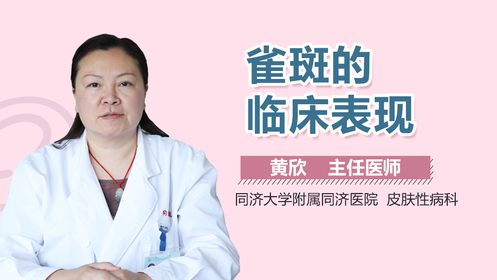 雀斑的临床表现