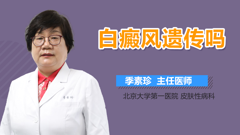 白癜风遗传吗