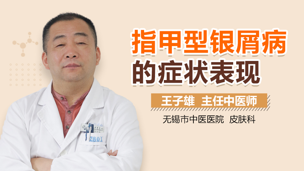 指甲型银屑病的症状表现