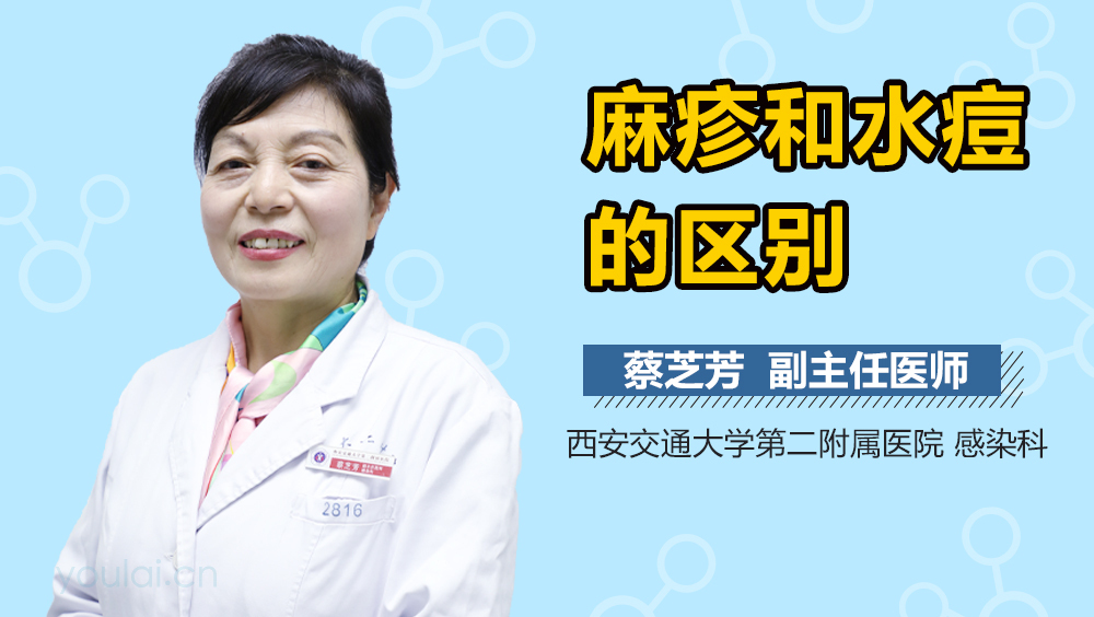 麻疹和水痘的区别