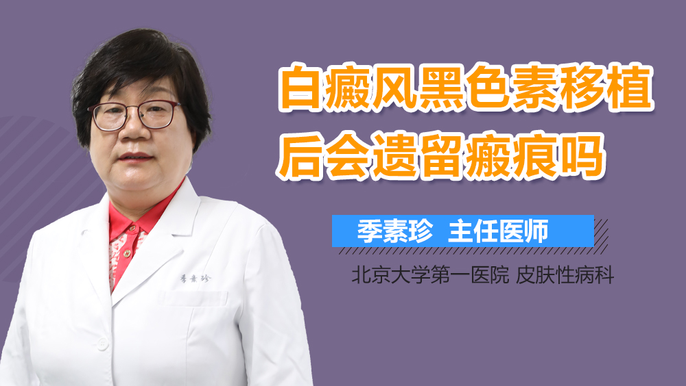 白癜风黑色素移植后会遗留瘢痕吗