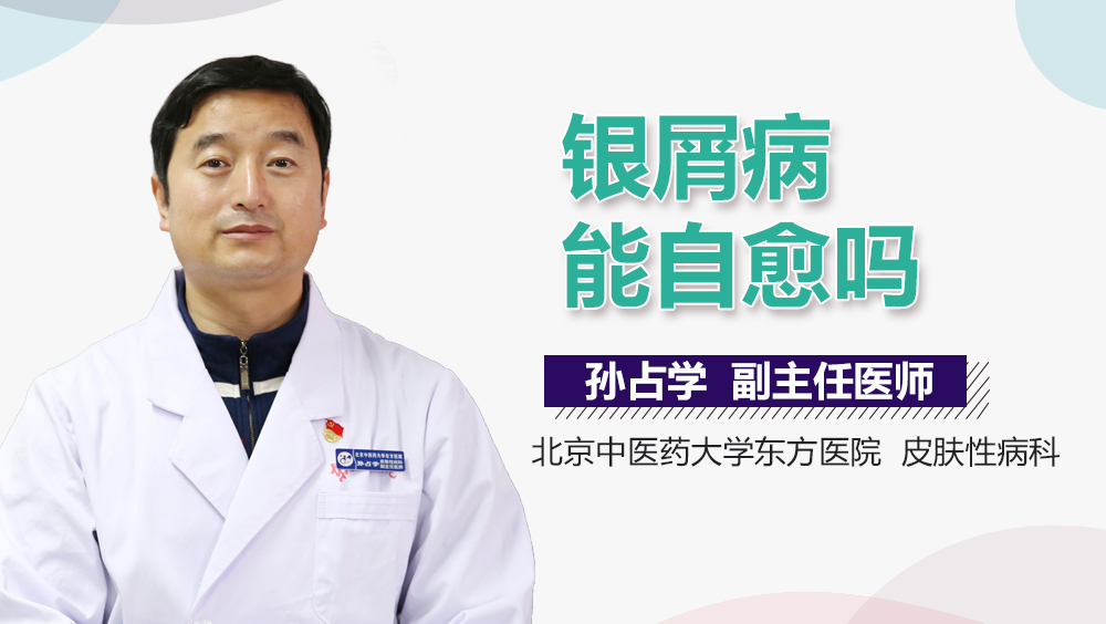银屑病能自愈吗
